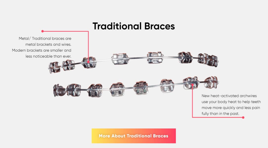 Braces for Adults Mount Kisco NY