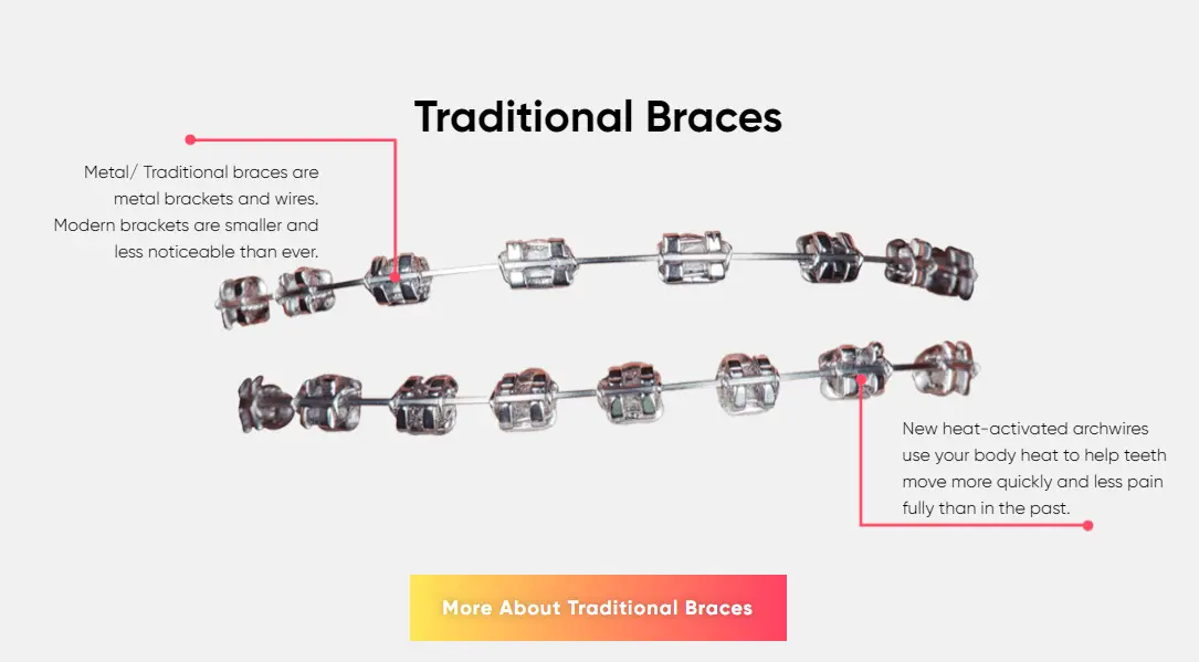 Braces for Adults Mount Kisco NY