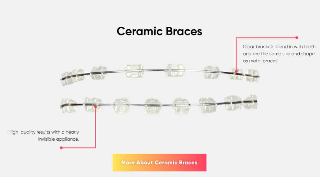 Creamic Braces in Mount Kisco NY