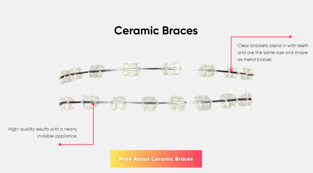 Creamic Braces in Mount Kisco NY