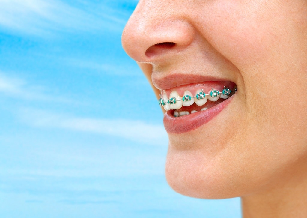 Best Orthodontist Near Me - 6 Ways To Get Perfect Smile