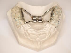 What Age Should A Child See An Orthodontist? Check Up By Age 7 What Age Should A Child See An Orthodontist?
