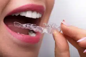 Invisalign Westchester NY