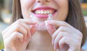 Invisalign Help