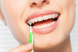 Teen Using Brush To Clean Clear Braces