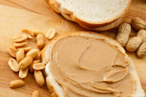 What To Eat After Getting Braces: A Complete First-Week Food Guide Food To Avoid After Getting Braces