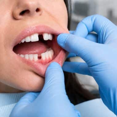 Orthodontist Evaluating Missing Tooth Space In Westchester