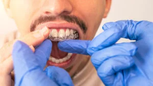Invisalign For Adults