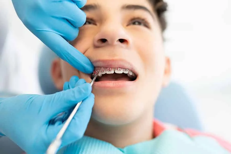 Teen Getting New Braces In Mount Kisco Ny