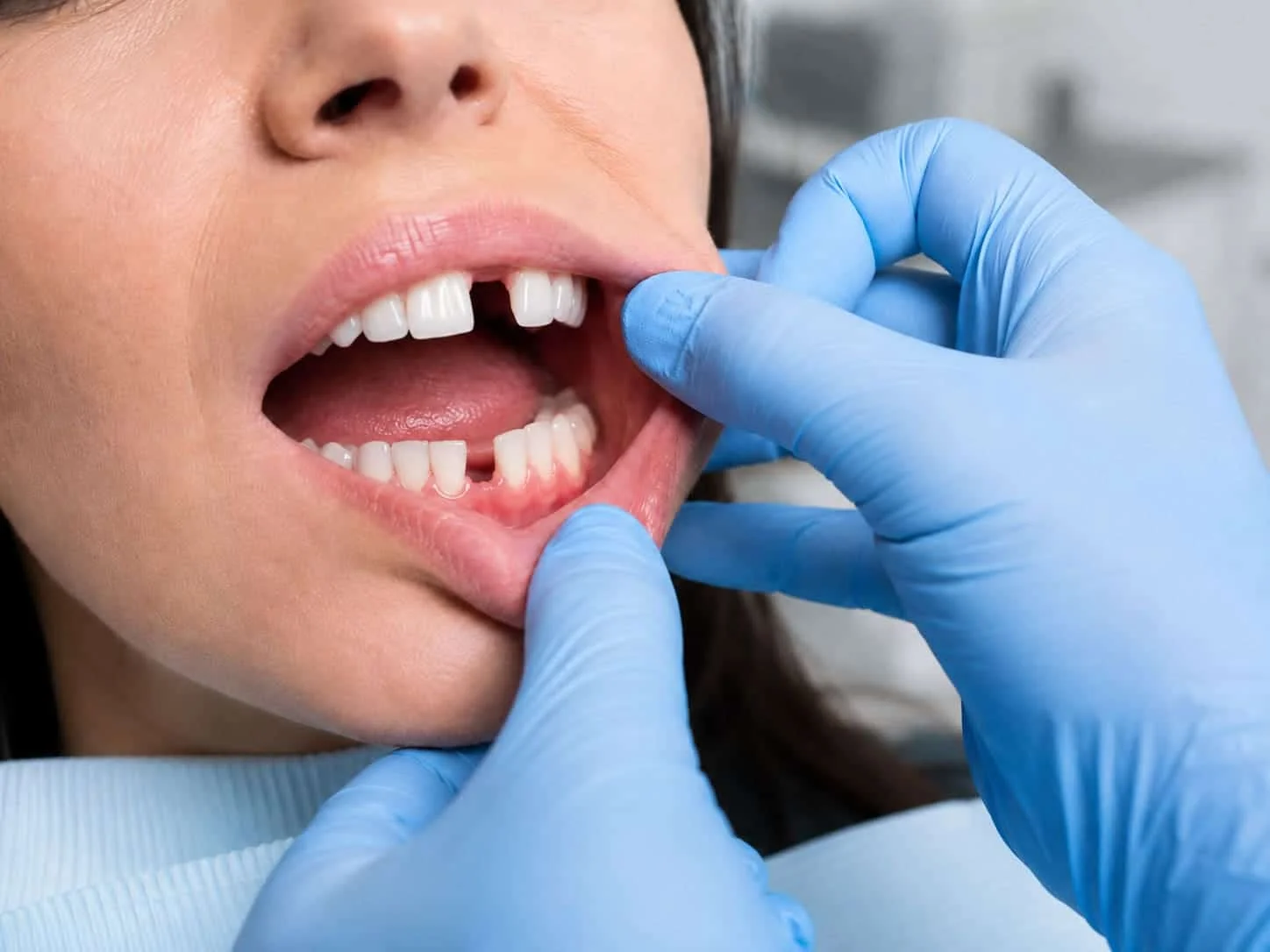 Orthodontist Evaluating Missing Tooth Space In Westchester